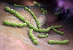 Streptococcus pneumoniae2